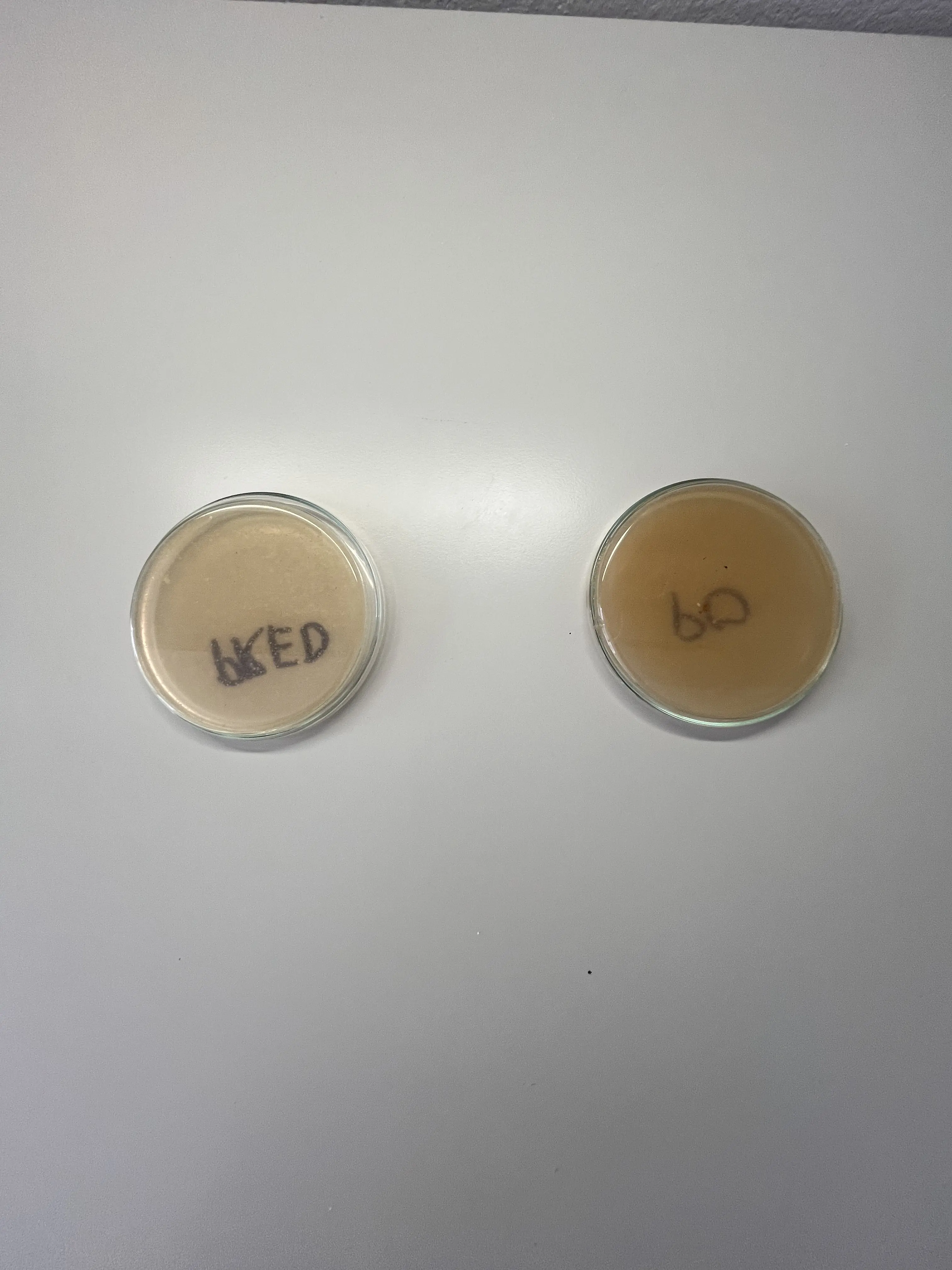 Petriho miska pred dezinfekciou - viditeľné kolónie baktérií